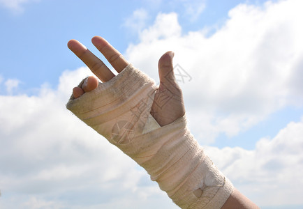 弹力绷带手腕疼痛的人 在巨型板条中 用天空背景的手指锻炼痛苦医师扭伤磁带从业者夹板事故绷带治愈伤口背景