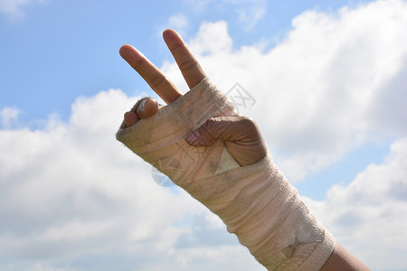弹力绷带手腕疼痛的人 在巨型板条中 用天空背景的手指锻炼扭伤绷带夹板治愈伤害手臂病人援助从业者疾病背景