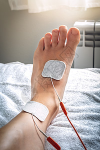 接受电StT医疗治疗的担架上的脚上高清图片
