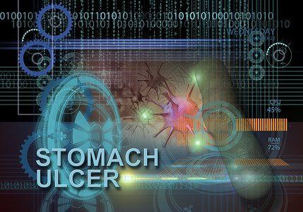 胃溃疡医疗高科技技术科学圆圈肠胃医学插图疾病数据背景图片