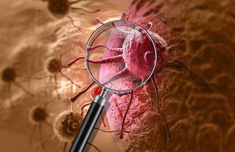 致癌细胞细胞细胞疾病宏观医疗微生物纳米细菌放大镜插图蓝色背景图片