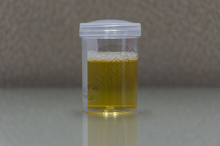 尿液分析用于实验室检查的尿液保健运动科学塑料身体测试液体小便玻璃化学品背景