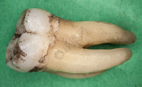 古老的有牙根的人类摩尔齿神经神经元臼齿棕色研磨搪瓷白色绿色咀嚼牙齿背景图片