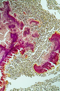 放线菌显微镜下活性肿瘤疾病 100x细胞组织考试细菌病理宏观医生组织学诊断科学背景