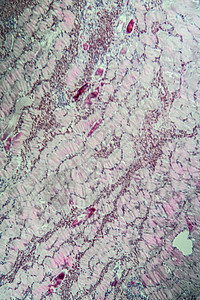 宫颈糜烂100x 肌肉中的沙子细胞类动物组织学疾病考试诊断宏观病理药品孢子科学组织背景