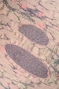 200x 肌肉中的沙子细胞类动物孢子科学考试组织药品医生宏观组织学细胞病理背景图片