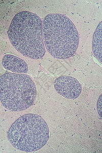 隐孢子虫200x 肌肉中的沙子细胞类动物病理疾病孢子组织学药品细胞考试医生宏观科学背景