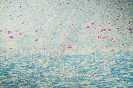 脑组织显微镜下神经细胞 100x组织诊断组织学宏观考试科学药品背景