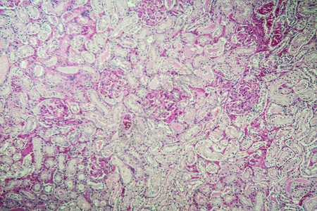 显微镜下的肾脏皮层 100x诊断老鼠康复皮质科学组织学胶囊单位肾小球组织背景图片