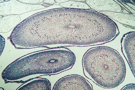 带蛋的横截切口圆虫100x寄生虫药品组织学蠕虫科学宏观肌肉诊断考试横截面背景图片