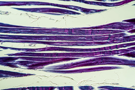 显微镜下断裂的肌肉组织 200x考试组织学药品诊断宏观科学背景图片