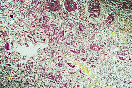 肾脏病组织学宏观高清图片