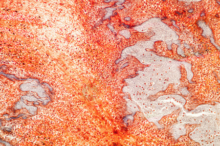 脂肪瘤显微镜下脂肪心脏组织疾病科学细胞放大镜冠状动脉肥胖药品纸巾蓝色纤颤背景