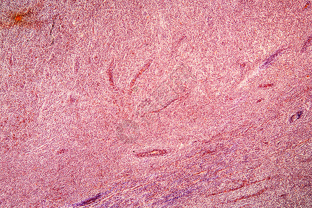 显微镜100x下横截面的杏仁科学组织药品宏观器官上颚感染细胞放大镜淋巴背景图片