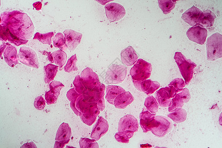 肠黏膜200x口腔菌菌菌的热室细胞蓝色黏膜粘膜组织学组织放大镜药品上皮科学宏观背景