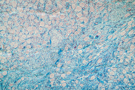 肠黏膜显微镜下色素组织 100x粘膜口腔组织学味觉科学细胞放大镜软腭上皮黏膜背景