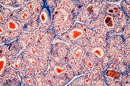 显微镜下的甲状腺组织 200x科学细胞荷尔蒙内分泌织囊荷尔蒙腺宏观放大镜内分泌腺药品背景