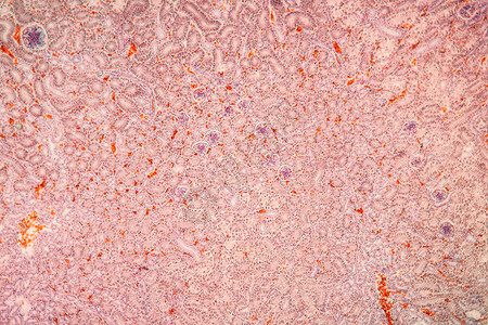 显微镜下的肾组织 100x组织学肾细胞排泄胶囊肾小球科学宏观放大镜细胞药品背景图片