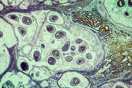 棘球绦虫显微术研究高清图片