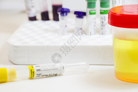 药检白底 彩色实验室检测容器上含血和其他管子的药物测试 医疗尿液和尿尿检验医院疾病液体药品化学品样本分析控制报告治疗背景