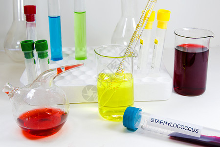 血和素材血试管样本 实验室和化学液体元素 COCPC 包括 活性临床微生物学测试科学治疗化学品制药保健药品感染背景