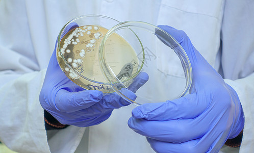 放线菌科学家向摄影机展示了Petri盘子里的细菌背景