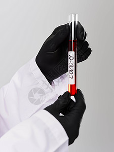 实验室助理 负责进行血检黑阴历19手套研究的化验室助理背景图片