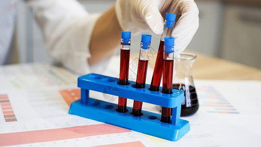 红色手套科学的手从站立处抽取血液采样管瓶子样本酒吧技术实验手套检查玻璃医院工具背景