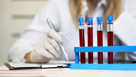 管综写作素材在化验室与血液样本一起工作的妇女 特查报告化学品微生物学临床药品疾病持有者女士器皿桌子背景