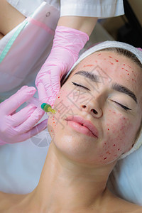 人脸老化素材医生向一个年轻女孩的脸部注射血等离子体医疗液体程序沙龙药品老化化妆品手套胶原注射器背景