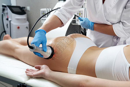 超声空化塑身治疗 在美容院接受抗脂肪团和抗脂肪治疗的妇女病人美容师女性程序保健沙龙组织空化卫生超声波背景