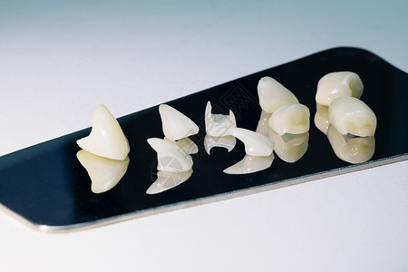 超薄瓷贴面牙科技术高清图片