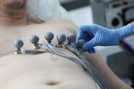 护士在病人胸前配有抽吸杯 记录心电图闭合男人医生胸肌考试情况韵律心肌胸部有氧运动药品背景图片