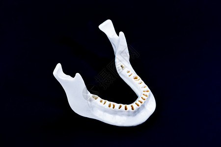 没有牙齿的下人下下下巴卫生手术王冠口服技术解剖学治疗假牙口腔科实验室图片