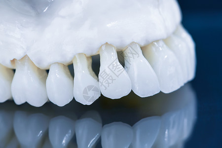 下巴特写上层人类下巴模型 玻璃上反射药品牙科口服美白牙齿牙医王冠技术矫正口腔科背景