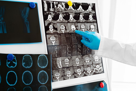 医生握着头骨扫描仪的手技术员专家x射线医师神经学家扫描放射科检查核磁共振男人背景图片