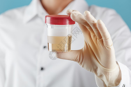 尿液标本医生拿着塑料袋的尿液 以供分析学习恐慌样本尿素实验室女士关心瓶子控制考试背景