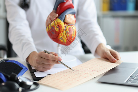 医生心脏病学家检查心血管病中病人心脏的心电图背景图片