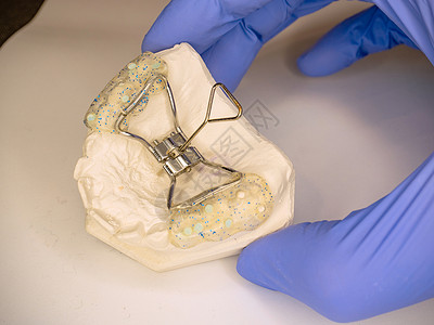 约束的在石膏副本上保存可调整的钢牙套制品男性器具工具扩展器诊断关节实验室医生牙列背景