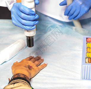 微晶换肤术一名皮肤科医生使用激光医疗装置清洗病人手臂上的皮肤 在外皮部进行化验时 请携带抗体外伤员检查背景