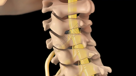 脊柱骨折子宫颈脊椎的解剖视图 以及间脊椎结膜抑制神经根骨折疝气药品整脊身体创伤骨骼外科压力疾病扫描背景