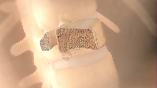 脊椎骨损伤损伤肩膀插图药品疼痛视频白色手指运动科学图片