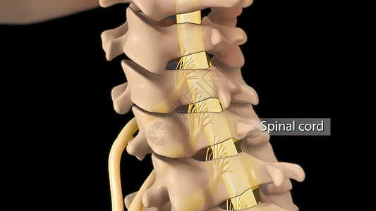脊柱骨折子宫颈脊椎的解剖视图 以及间脊椎结膜抑制神经根骨折医院椎骨骨科疝气手术外科脊柱绳索疼痛柱子背景