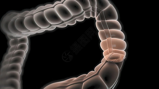 焚烧卫生分解切除肠道任何部分的外科手术 肠内分解大肠解剖学癌症绘画图表外套便秘眼镜粘膜卫生背景