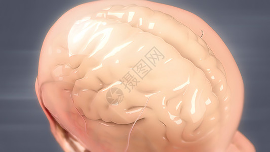 人类大脑解解剖模型3D血管疾病卫生神经系统交通血液障碍出血药品流量背景图片