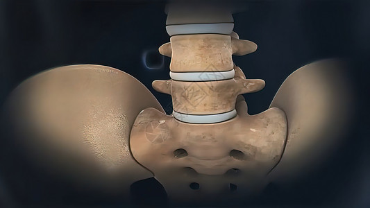 抑制对脊柱骨的关节炎影响椎骨骨头痛苦药品老年保健医疗脊椎压缩卫生图片