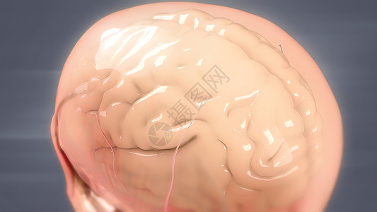 人类大脑解解剖模型3D障碍出血器官高血压并发症状况中脑供应动脉交通背景图片