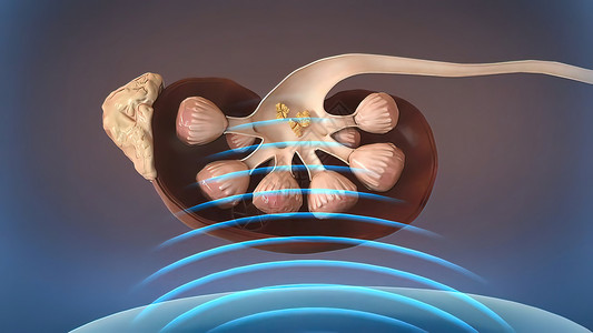 激波关心肾脏高清图片