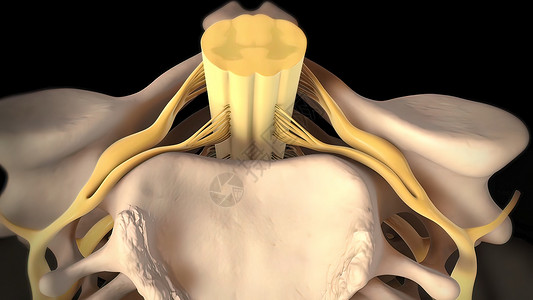 脊椎膜切除是脊椎骨间缓冲和连接组织受伤的伤痕状况骨科脊柱整脊骨头手术髓质外科插图疗法图片