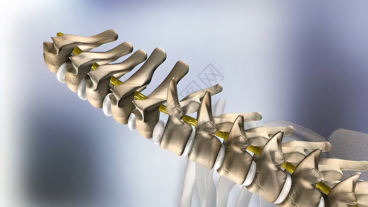 椎间孔镜三维医疗三维3D插图 子宫颈脊椎骨骼骨干柱子药品压力骨科症状疝气椎间外科背景